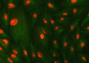 Immunofluorescent staining of FFPE human A549 cells with SMC1A antibody (red) and Beta Tubulin mAb (green). HIER: steam section in pH6 citrate buffer for 20 min.