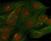 Immunofluorescent staining of FFPE human HeLa cells with SMC5 antibody (red) and Beta Tubulin mAb (green). HIER: steam section in pH6 citrate buffer for 20 min.