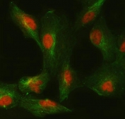 Immunofluorescent staining of FFPE human A549 cells with SMC6 antibody (red) and Beta Tubulin mAb (green). HIER: steam section in pH6 citrate buffer for 20 min.