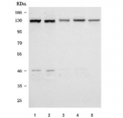 Western blot testing of 1) human K562, 2) human HEL, 3) human A431, 4) human U-251 and 5) rat testis tissue lysate with SMC6 antibody. Predicted molecular weight ~126 kDa.