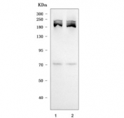 Western blot testing of human 1) HepG2 and 2) HeLa cell lysate with SMCHD1 antibody. Predicted molecular weight ~226 kDa.