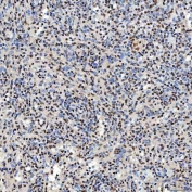 IHC staining of FFPE human spleen tissue with SNRNP40 antibody. HIER: boil tissue sections in pH8 EDTA for 20 min and allow to cool before testing.