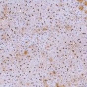 IHC staining of FFPE mouse liver tissue with SNRNP40 antibody. HIER: boil tissue sections in pH8 EDTA for 20 min and allow to cool before testing.