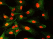 Immunofluorescent staining of FFPE human A549 cells with SNRNP40 antibody (red) and Beta Tubulin mAb (green). HIER: steam section in pH6 citrate buffer for 20 min.