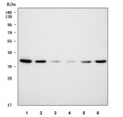Western blot testing of 1) human 293T, 2) human HeLa, 3) rat C6, 4) mouse brain, 5) mouse testis and 6) mouse NIH 3T3 cell lysate with SNRNP40 antibody. Predicted molecular weight: 39-45 kDa.
