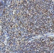 IHC staining of FFPE rat spleen tissue with SNRNP40 antibody. HIER: boil tissue sections in pH8 EDTA for 20 min and allow to cool before testing.