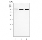 Western blot testing of human 1) Jurkat, 2) 293T and 3) U-87 MG cell lysate with RASGRP1 antibody. Predicted molecular weight ~90 kDa with multiple smaller isoforms.