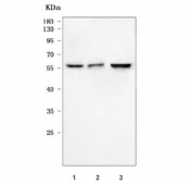 Western blot testing of human 1) HeLa, 2) U-2 OS and 3) MOLT4 cell lysate with RNMT antibody. Predicted molecular weight ~55 kDa.