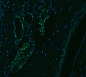 Immunofluorescent staining of FFPE human prostate cancer tissue with U2 snRNP A antibody (green) and DAPI nuclear stain (blue). HIER: steam section in pH8 EDTA buffer for 20 min.