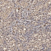 IHC staining of FFPE human testicular seminoma tissue with U2 snRNP A antibody. HIER: boil tissue sections in pH8 EDTA for 20 min and allow to cool before testing.