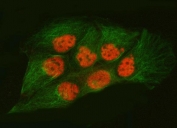 Immunofluorescent staining of FFPE human Caco-2 cells with U2 snRNP A antibody (red) and Beta Tubulin mAb (green). HIER: steam section in pH6 citrate buffer for 20 min.