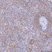 IHC staining of FFPE human spleen tissue with U1 snRNP C antibody. HIER: boil tissue sections in pH8 EDTA for 20 min and allow to cool before testing.