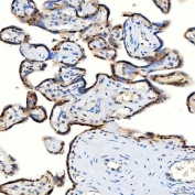 IHC staining of FFPE human placental tissue with U1 snRNP C antibody. HIER: boil tissue sections in pH8 EDTA for 20 min and allow to cool before testing.