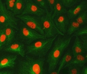 Immunofluorescent staining of FFPE human A549 cells with U1 snRNP C antibody (red) and Beta Tubulin mAb (green). HIER: steam section in pH6 citrate buffer for 20 min.