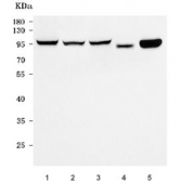 Western blot testing of 1) human MCF7, 2) human HeLa, 3) monkey COS-7, 4) rat heart and 5) mouse heart with EIF4G2 antibody. Expected molecular weight ~97 kDa.