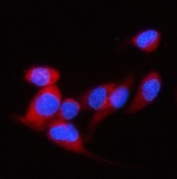 Immunofluorescent staining of FFPE human EIF4G2 cells with DAP5 antibody (red) and DAPI nuclear stain (blue). HIER: steam section in pH6 citrate buffer for 20 min.