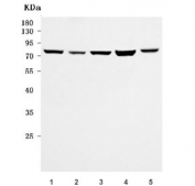 Western blot testing of 1) human U-87 MG, 2) human K562, 3) human Daudi, 4) human HEL1 and 5) mouse ovary tissue lysate with URI1 antibody. Predicted molecular weight ~60 kDa, can be observed at 70-80 kDa.