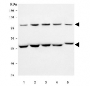 Western blot testing of 1) human HeLa, 2) human 293T, 3) human MOLT4, 4) human RT4 and 5) rat C6 cell lysate with OTT3 antibody. Predicted molecular weight ~97 kDa, but can be observed at up to ~120 kDa. There is a short form of the protein that is observed at ~63 kDa.
