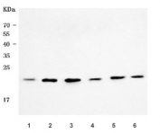 Western blot testing of 1) human PC-3, 2) human HepG2, 3) human HeLa, 4) human SiHa, 5) rat testis and 6) mouse testis tissue lysate with RNF212 antibody. Predicted molecular weight: 14-33 kDa (multiple isoforms).