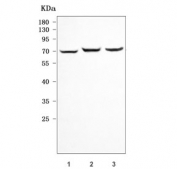 Western blot testing of 1) rat PC-12, 2) rat thymus and 3) mouse RAW264.7 cell lysate with Antigen peptide transporter 1 antibody. Predicted molecular weight ~79 kDa.