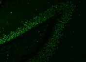 Immunofluorescent staining of FFPE rat brain tissue with SNRNP27 antibody (green). HIER: steam section in pH8 EDTA buffer for 20 min.
