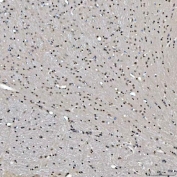 IHC staining of FFPE mouse brain tissue with SNRNP27 antibody. HIER: boil tissue sections in pH8 EDTA for 20 min and allow to cool before testing.