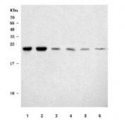 Western blot testing of 1) human 293T, 2) human MOLT4, 3) human placenta, 4) rat brain, 5) mouse brain, 6) mouse liver tissue lysate with SNRNP27 antibody. Predicted molecular weight ~19 kDa.