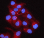 Immunofluorescent staining of FFPE human HeLa cells with Small ribosomal subunit protein uS7 antibody (red) and DAPI nuclear stain (blue). HIER: steam section in pH6 citrate buffer for 20 min.