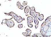IHC staining of FFPE human placental tissue with Small ribosomal subunit protein uS7 antibody. HIER: boil tissue sections in pH8 EDTA for 20 min and allow to cool before testing.