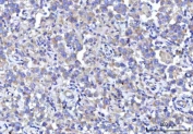 IHC staining of FFPE human testicular seminoma tissue with Small ribosomal subunit protein uS7 antibody. HIER: boil tissue sections in pH8 EDTA for 20 min and allow to cool before testing.