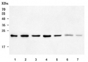 Western blot testing of 1) human 293T, 2) human HeLa, 3) human Jurkat, 4) human HepG2, 5) rat liver, 6) mouse liver and 7) mouse ovary tissue lysate with Small ribosomal subunit protein uS7 antibody. Predicted molecular weight ~23 kDa.