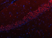 Immunofluorescent staining of FFPE rat brain tissue with Regulatory factor X 3 antibody (red) and DAPI nuclear stain (blue). HIER: steam section in pH8 EDTA buffer for 20 min.