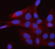 Immunofluorescent staining of FFPE human U-2 OS cells with smgGDS antibody (red) and DAPI nuclear stain (blue). HIER: steam section in pH6 citrate buffer for 20 min.