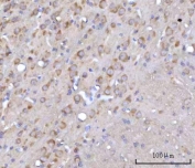 IHC staining of FFPE mouse brain tissue with ArgRS antibody. HIER: boil tissue sections in pH8 EDTA for 20 min and allow to cool before testing.