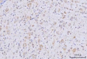 IHC staining of FFPE rat brain tissue with ArgRS antibody. HIER: boil tissue sections in pH8 EDTA for 20 min and allow to cool before testing.