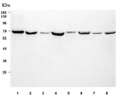 Western blot testing of 1) human HeLa, 2) human MCF7, 3) human A431, 4) human 293T, 5) rat liver, 6) rat RH35, 7) mouse liver and 8) mouse NIH 3T3 cell lysate with ArgRS antibody. Predicted molecular weight ~75 kDa and ~67 kDa (two isoforms).