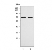 Western blot testing of human 1) HeLa and 2) 293T cell lysate with RIOK3 antibody. Predicted molecular weight ~59 kDa, commonly observed at 59-65 kDa.