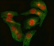 Immunofluorescent staining of FFPE human HeLa cells with GNB1 antibody (red) and Alpha Tubulin mAb (green). HIER: steam section in pH6 citrate buffer for 20 min.