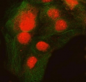 Immunofluorescent staining of FFPE human Caco-2 cells with SNRNP200 antibody (red) and Beta Tubulin mAb (green). HIER: steam section in pH6 citrate buffer for 20 min.