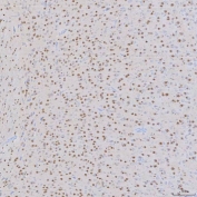IHC staining of FFPE mouse brain tissue with SNRNP200 antibody. HIER: boil tissue sections in pH8 EDTA for 20 min and allow to cool before testing.