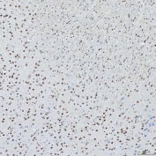 IHC staining of FFPE rat brain tissue with SNRNP200 antibody. HIER: boil tissue sections in pH8 EDTA for 20 min and allow to cool before testing.