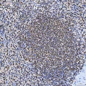 IHC staining of FFPE human spleen tissue with SNRNP200 antibody. HIER: boil tissue sections in pH8 EDTA for 20 min and allow to cool before testing.