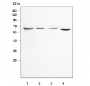 Western blot testing of 1) human HepG2, 2) human HUH-7, 3) human HCCT and 4) rat liver tissue lysate with RETSAT antibody. Predicted molecular weight ~67 kDa.