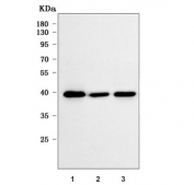Western blot testing of human 1) Daudi, 2) MOLT4 and 3) HepG2 cell lysate with RBFA antibody. Predicted molecular weight ~38 kDa.