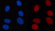 Immunofluorescent staining of FFPE human U-2 OS cells with RANBP2 antibody (red) and DAPI nuclear stain (blue). HIER: steam section in pH6 citrate buffer for 20 min.