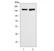 Western blot testing of 1) rat eye and 2) mouse eye tissue lysate with IRBP antibody. Predicted molecular weight ~135 kDa.