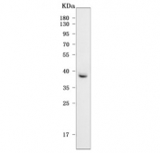 Western blot testing of human HCCT cell lysate with Paraoxonase 2 antibody. Predicted molecular weight: ~39/39/38 kDa (isoforms 1/2/3). 