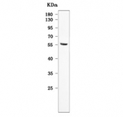 Western blot testing of human ThP-1 cell lysate with TMEM104 antibody. Predicted molecular weight ~56 kDa.