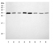 Western blot testing of 1) human RT4, 2) human HaCaT, 3) human SH-SY5Y, 4) human T-47D, 5) rat brain, 6) rat PC-12, 7) mouse brain and 8) mouse Neuro-2a cell lysate with STX6 antibody. Predicted molecular weight ~29 kDa.