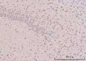 IHC staining of FFPE rat brain tissue with RBM25 antibody. HIER: boil tissue sections in pH8 EDTA for 20 min and allow to cool before testing.